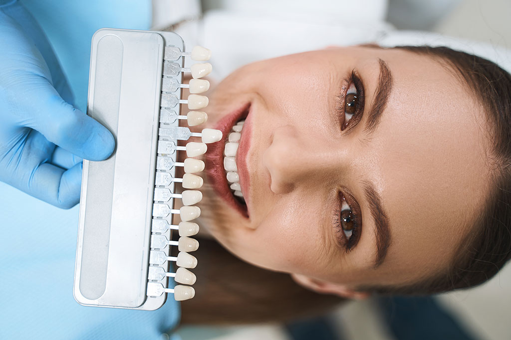 Photo of a Woman at dentist with Veneers choices